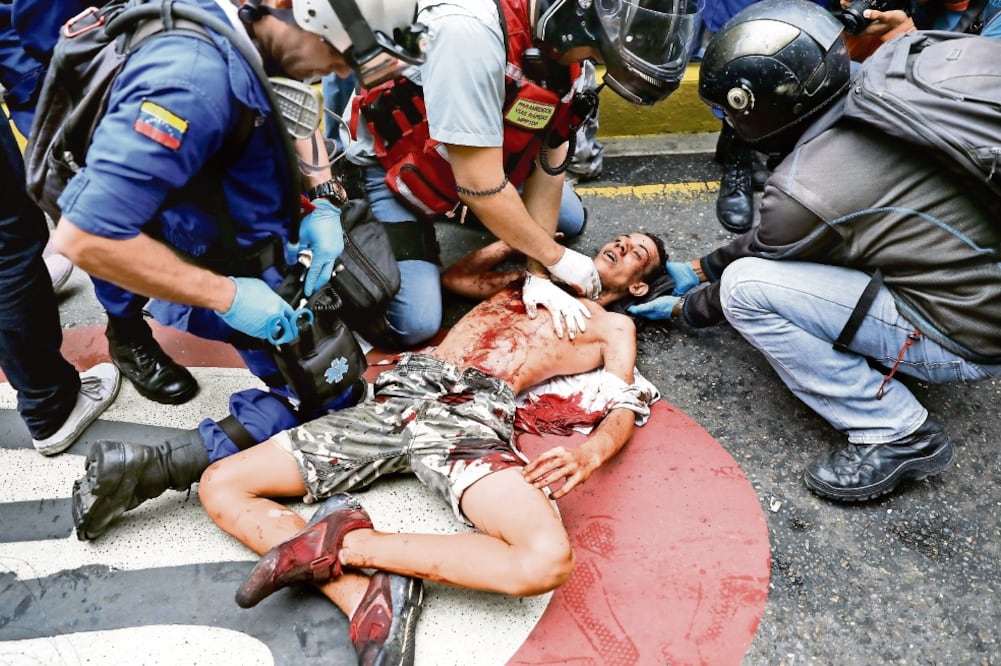 Medios lo identificaron como Neomar Lander, de 17 años y quien perdió la vida tras ser impactado, según la oposición, por una bomba lacrimógena disparada por uniformados en Caracas (CARLOS GARCÍA RAWLINS. REUTERS)