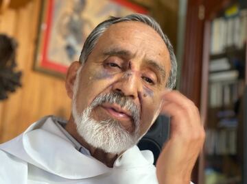 Me salió barato, pudo costarme la vida, dice sacerdote de Michoacán golpeado
