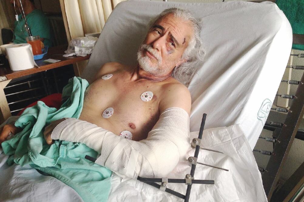 Luis Alberto Marín Aguilar tiene cinco puntadas en la frente, el brazo fracturado y más lesiones después de caer de un edificio durante el sismo (CORTESÍA)