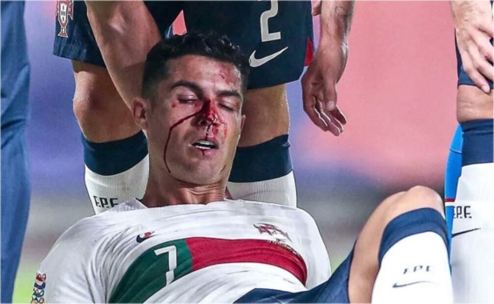 VIDEO: El sangriento golpe que recibió Cristiano Ronaldo jugando con Portugal