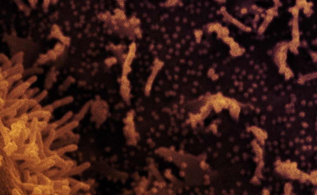 Foto: EFE/EPA/NIAID/NATIONAL INSTITUTES OF HEALTH