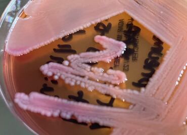 Estas son las bacterias más peligrosas del mundo: estudio