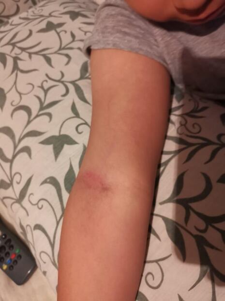 Policías privados golpean a mujer y a su hijo de 10 años en plaza de Tlalnepantla 