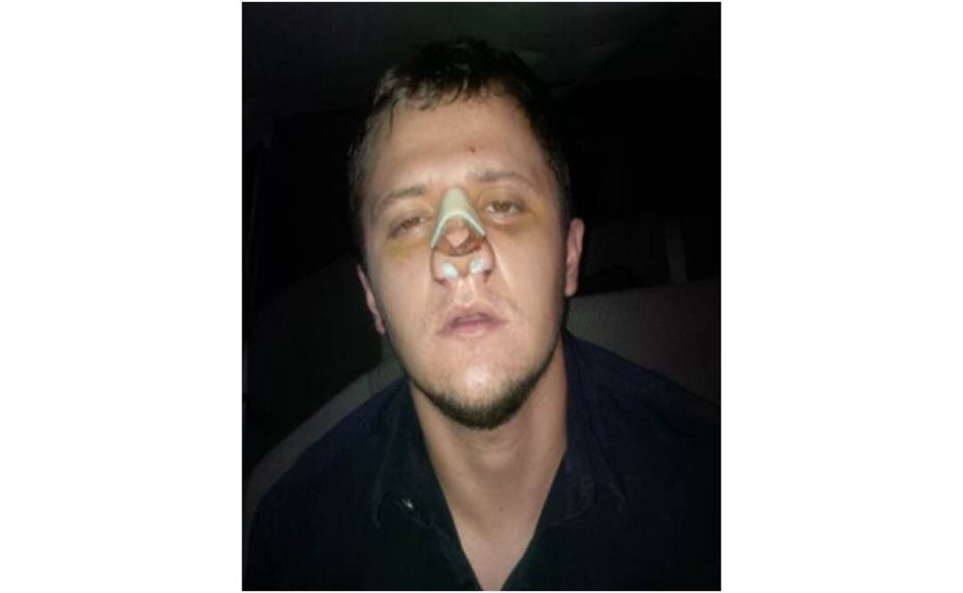 Rubén Oseguera González, "El Menchito", hijo del presunto líder del Cártel Jalisco Nueva Generación (CJNG), se manejaba con bajo perfil e incluso se había operado la nariz, dijo en conferencia de prensa Monte Alejandro Rubido, Comisionado Nacional de Seguridad. Foto Especial