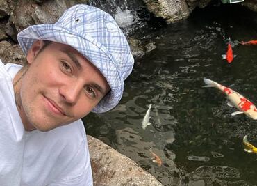 Justin Bieber recupera la sonrisa tras ser diagnosticado con rara enfermedad que provoca parálisis facial