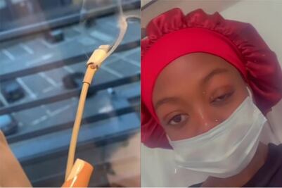 Joven queda parcialmente ciega luego que el cable de su teléfono explotara