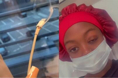 Joven queda parcialmente ciega luego que el cable de su teléfono explotara