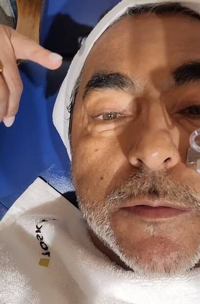 Raúl Araiza se somete a procedimiento estético en el rostro y lo presume en redes