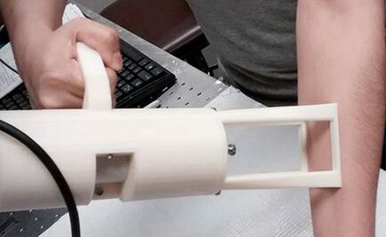 Mexicanos en Harvard crean aparato para tratar cicatrices