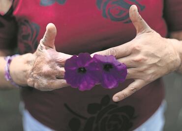 Ataques con ácido; reclaman mayores penas