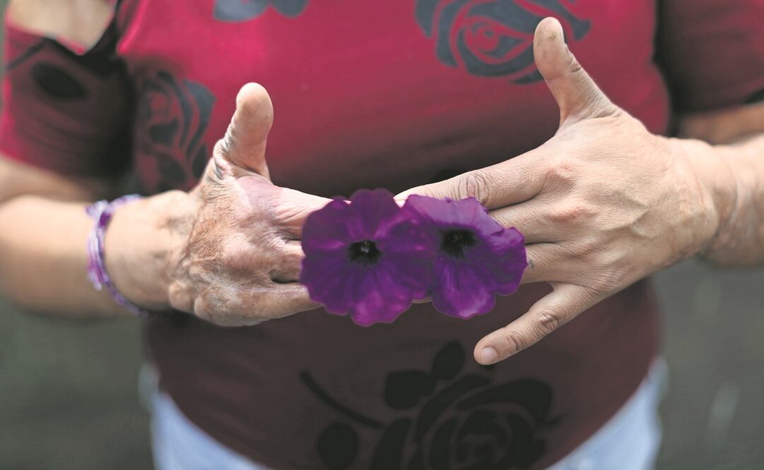 Ataques con ácido; reclaman mayores penas