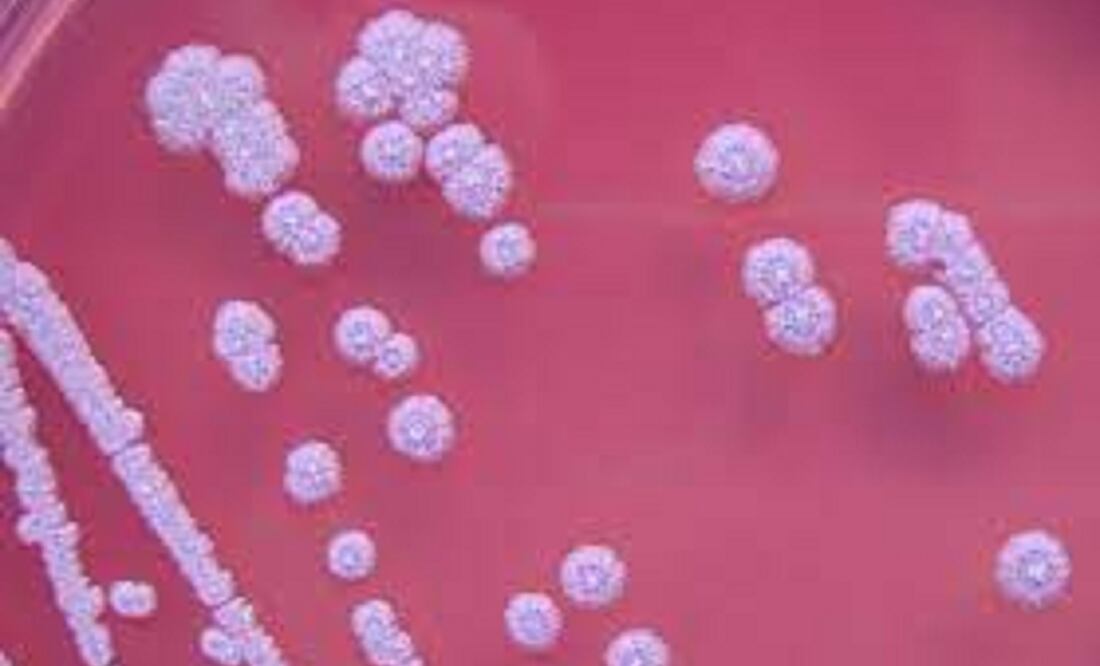 La melioidosis es una infección de humanos y animales producida por la bacteria Burkholderia pseudomallei, un microorganismo que se encuentra en campos de sembrado de arroz y en aguas estancadas en los trópicos. Foto: Especial