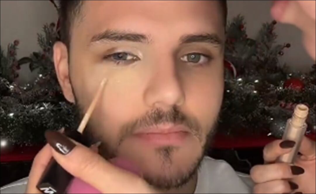 Wanda Nara ocultó el golpe de Icardi con maquillaje / Foto: Especiales