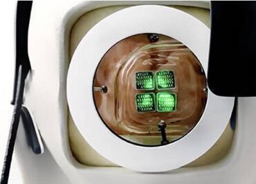 Ojo biónico promete una nueva oportunidad a personas con ceguera