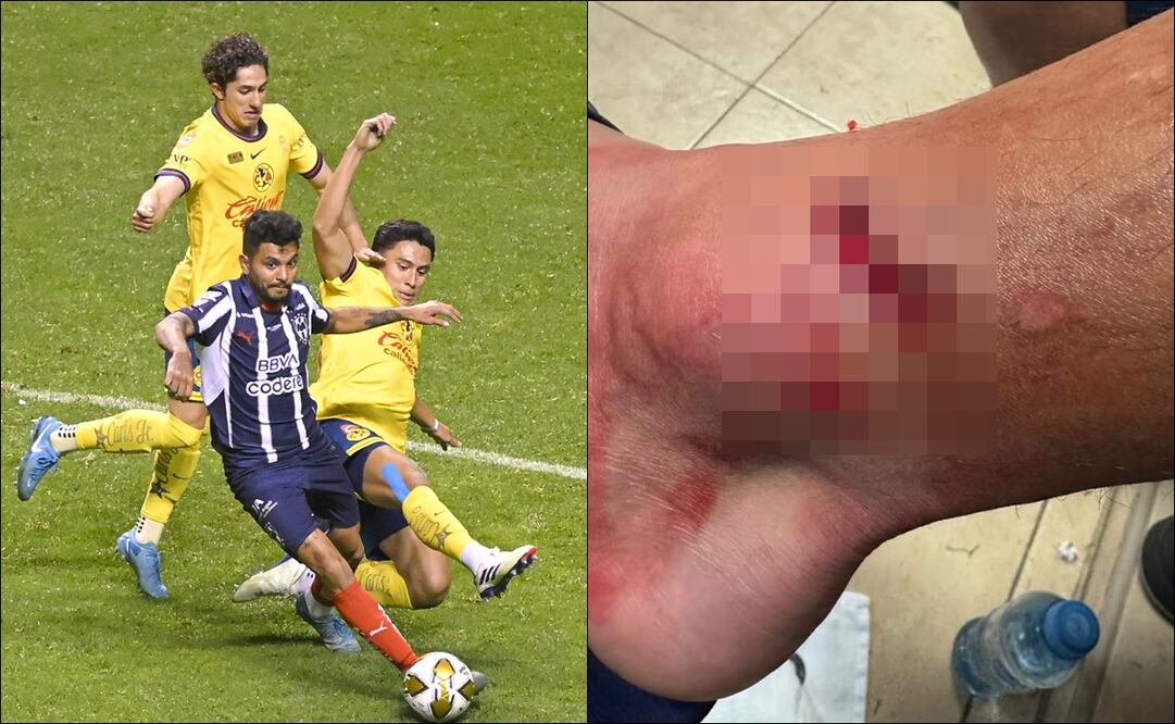Así fue la impresionante herida de Jesús ‘Tecatito’ Corona; en la final de ida ante el América / FOTOS: Imago7 e Instagram (jesustecatitoc)