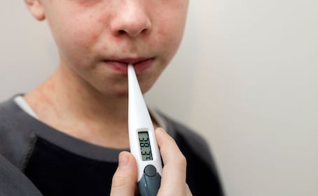 ¿Cómo se contagia el sarampión? Síntomas y quiénes deben vacunarse