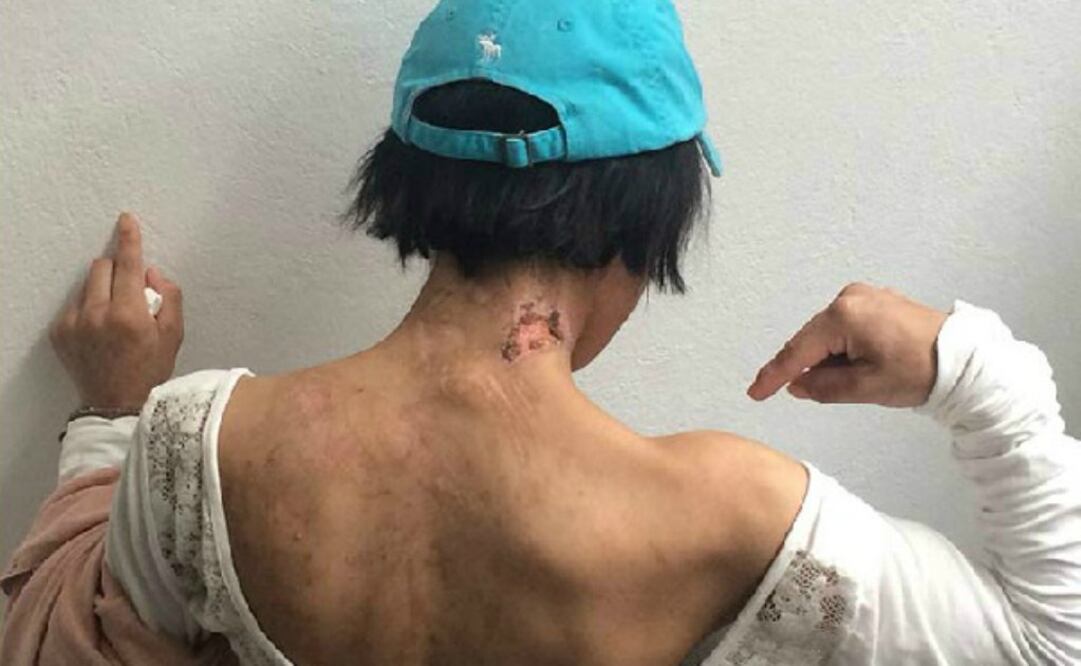 CNDH: 'deleznable', la esclavitud en pleno Siglo XXI