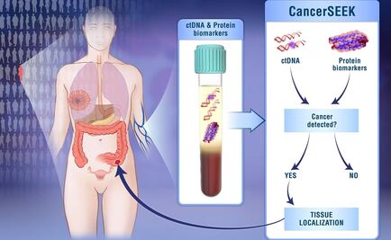 Con un sólo análisis de sangre se podrán detectar ocho tipos de cáncer
