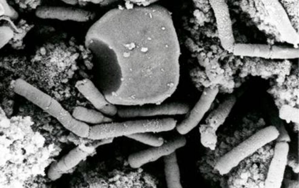 Confirman 20 casos de ántrax cutáneo al norte de China