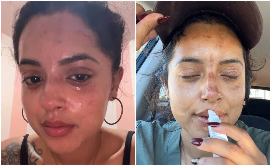 Abigail Rivera, hija del cantante Lupillo Rivera sufrió daños en su rostro tras incidente en su camión de comida.