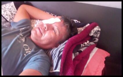 Denuncia falta de apoyo árbitro que casi pierde el ojo