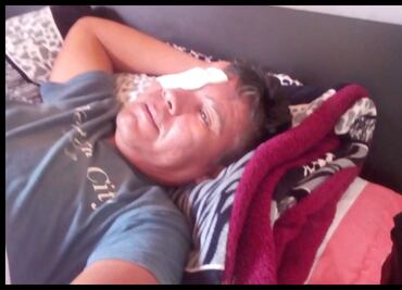 Denuncia falta de apoyo árbitro que casi pierde el ojo