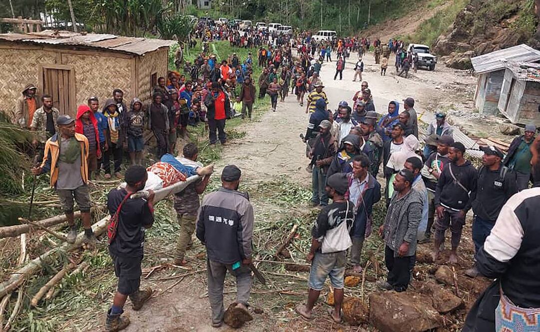 Una persona lesionada es cargada en una camilla para solicitar asistencia médica tras un deslave en el poblado de Yambali. Foto:AP