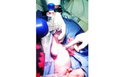 Abandonan a recién nacido en carretera Actopan-Tula