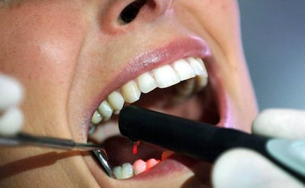 Respirar por la boca al dormir aumenta riesgo de caries