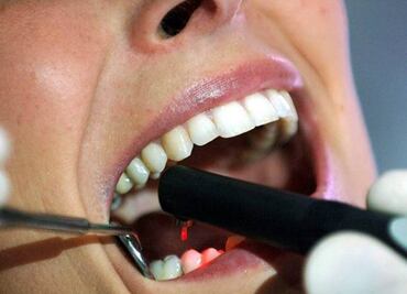 Respirar por la boca al dormir aumenta riesgo de caries