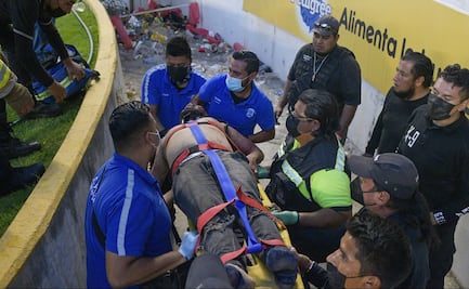 Aficionado perdió el ojo tras trifulca en La Corregidora