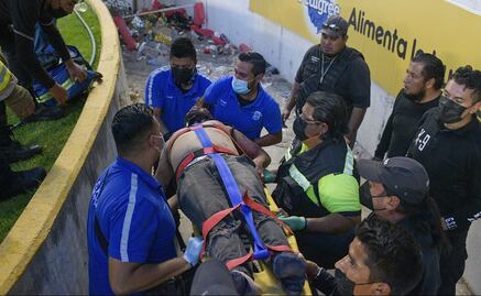 Aficionado perdió el ojo tras trifulca en La Corregidora