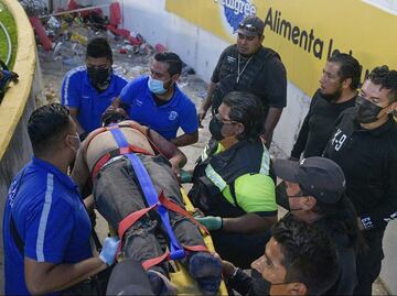 Aficionado perdió el ojo tras trifulca en La Corregidora