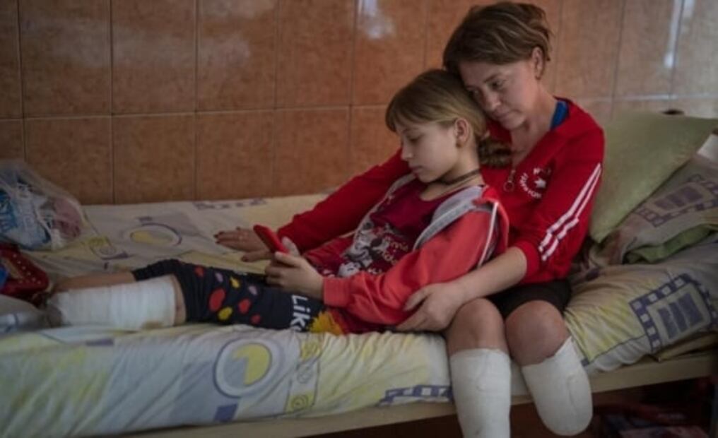 Amputados: el costo humano de la guerra Rusia VS Ucrania 