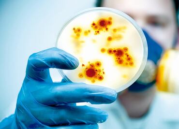 ¿Qué es la brucelosis? Síntomas, causas y cómo tratar la enfermedad