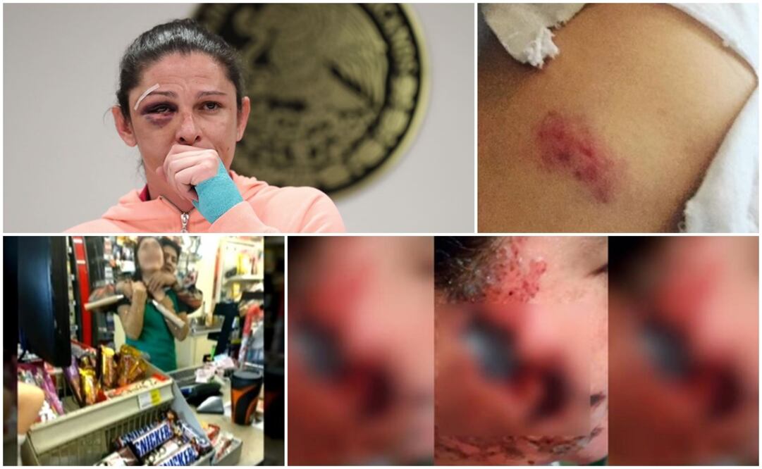 Senadora, cantante, cajera y ama de casa, agredidas en una semana