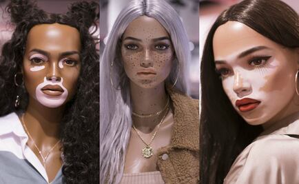 ¿Maniquíes con estrías y vitiligo? Esta marca redefine la belleza femenina
