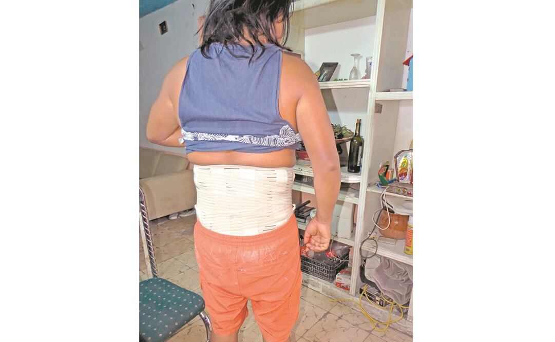 Debido a que Leobardo tuvo fracturas en las lumbares tras el derrumbe del Metro, ahora tiene que usar una faja de manera permanente. Foto: Ignacio Ramírez. EL UNIVERSAL