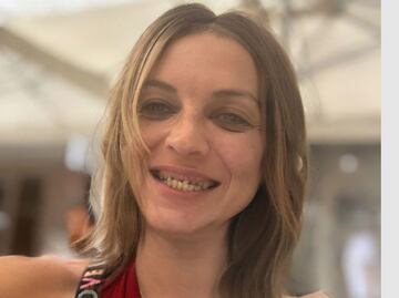 ¿Qué pasó con los dientes de Camilo Blanes, el hijo de Camilo Sesto?