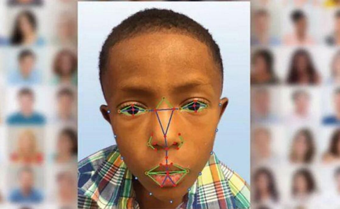 Tecnología analiza las facciones del paciente para poder detectar el "Síndrome de DiGeorge". (FOTO: National Human Genome Research Institute)