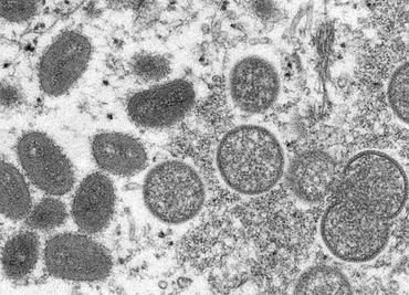 Primer caso de transmisión de viruela del mono en un perro doméstico