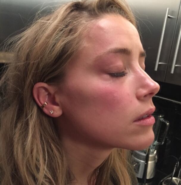 Amber Heard fingió golpes en el rostro: amigo de Jhonny Depp