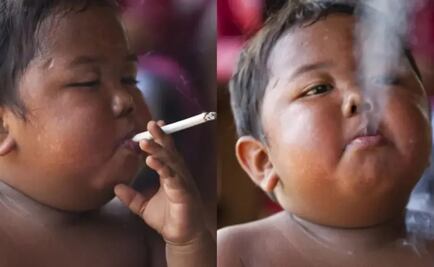 Así luce Aldi Rizal, el bebé que fumaba 40 cigarrillos al día y cuyo caso conmocionó al mundo