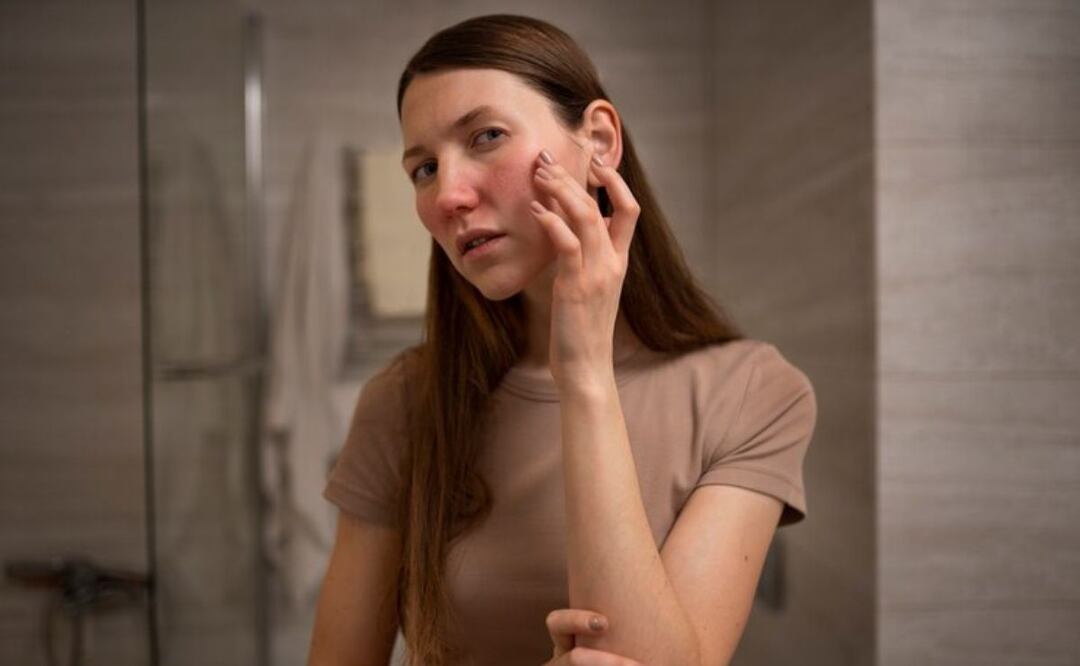 Una especia contra el acné. Fuente: Freepik