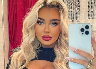 Tiktoker se arrepiente de rellenarse los labios y el resultado es aún peor