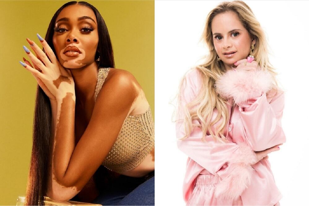 Las mujeres han recorrido un largo camino para romper los estereotipos en la moda / Foto: Instagram @winnieharlow y @sofiajirau
