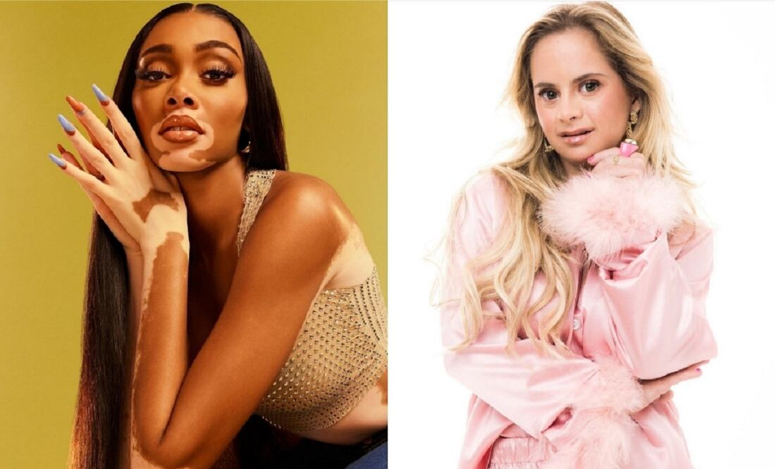 Las mujeres han recorrido un largo camino para romper los estereotipos en la moda / Foto: Instagram @winnieharlow y @sofiajirau