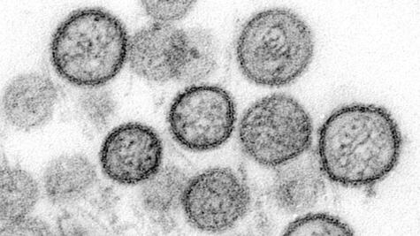 Hantavirus: por qué preocupa el brote que ha causado la muerte de 9 personas