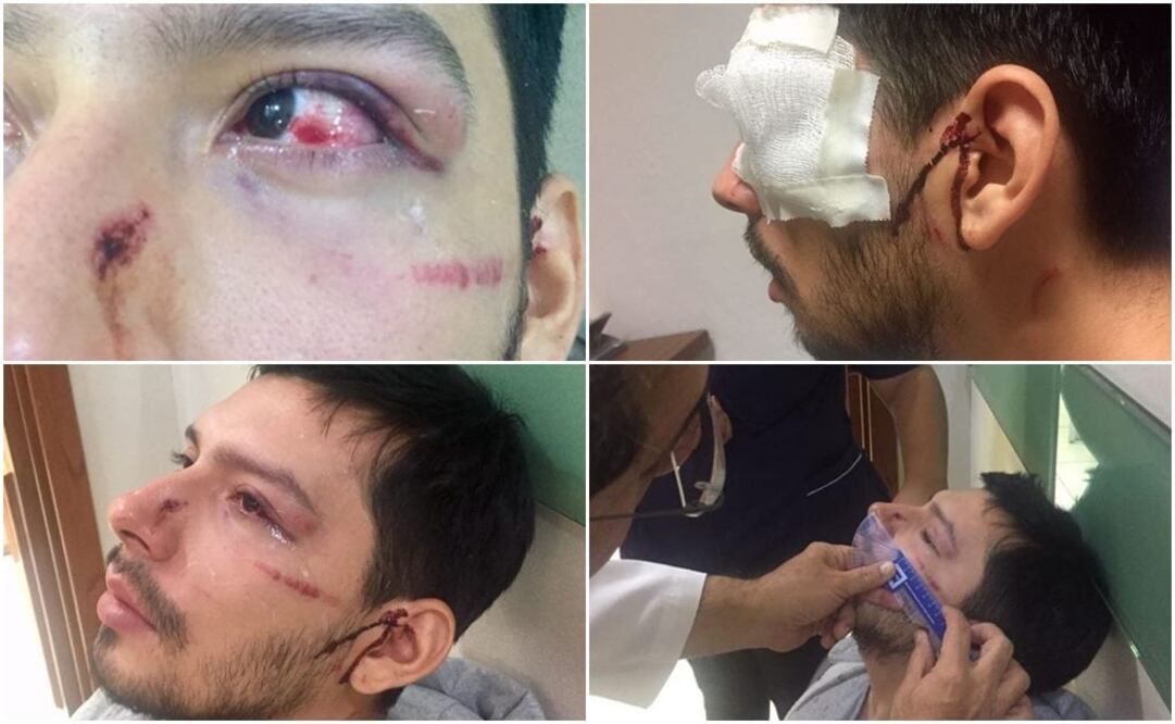 Fotos: Mauricio Mayorga