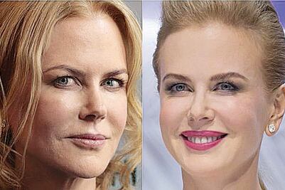 Así luce la nueva cara de Nicole Kidman